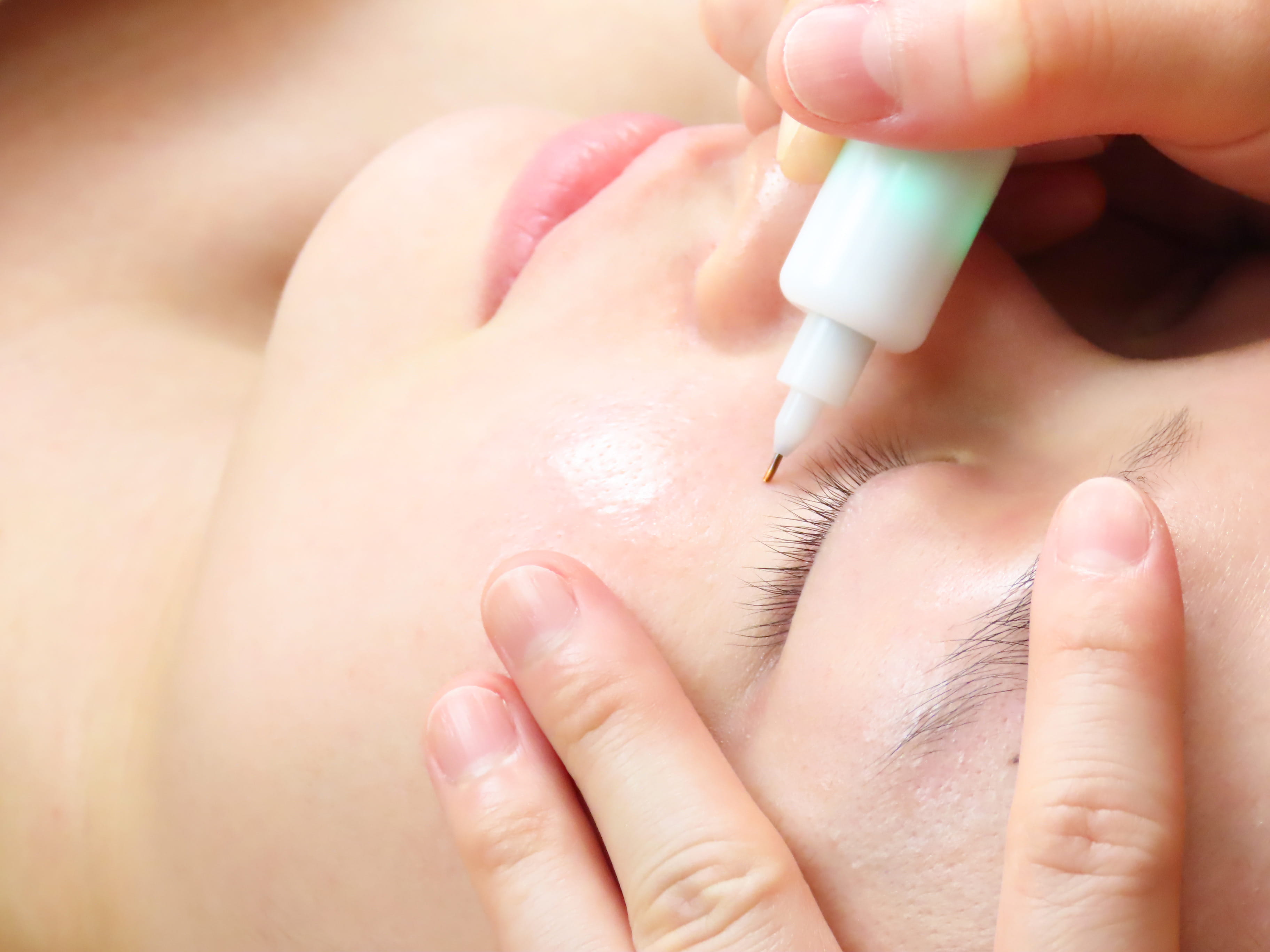 頬のトリートメント施術